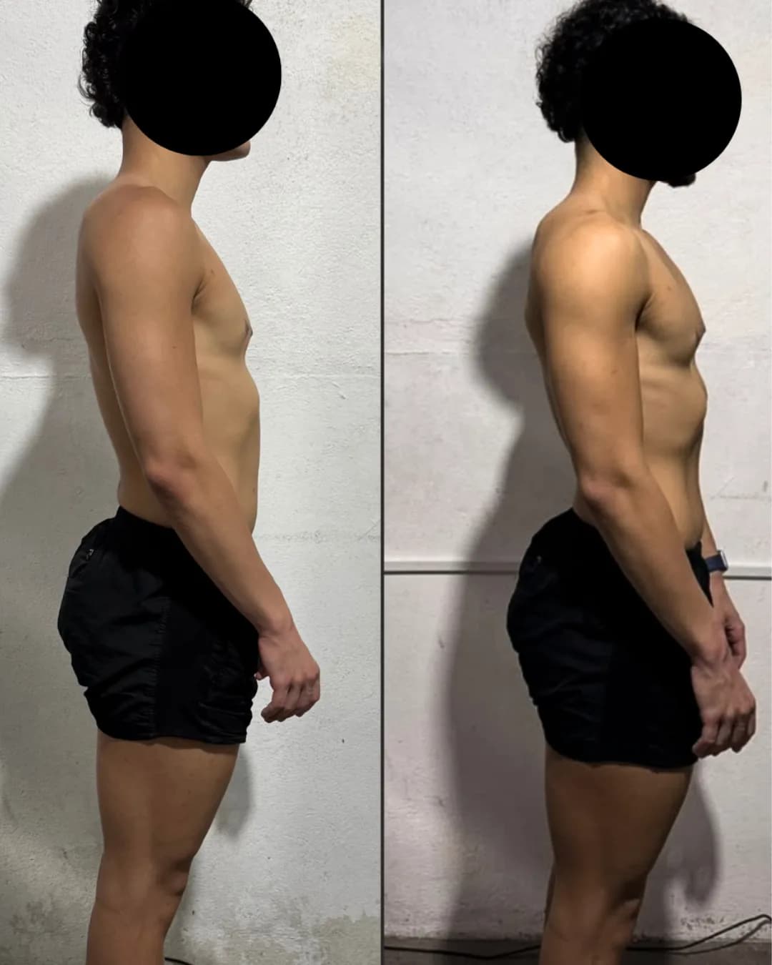 Antes e depois – resultado 11