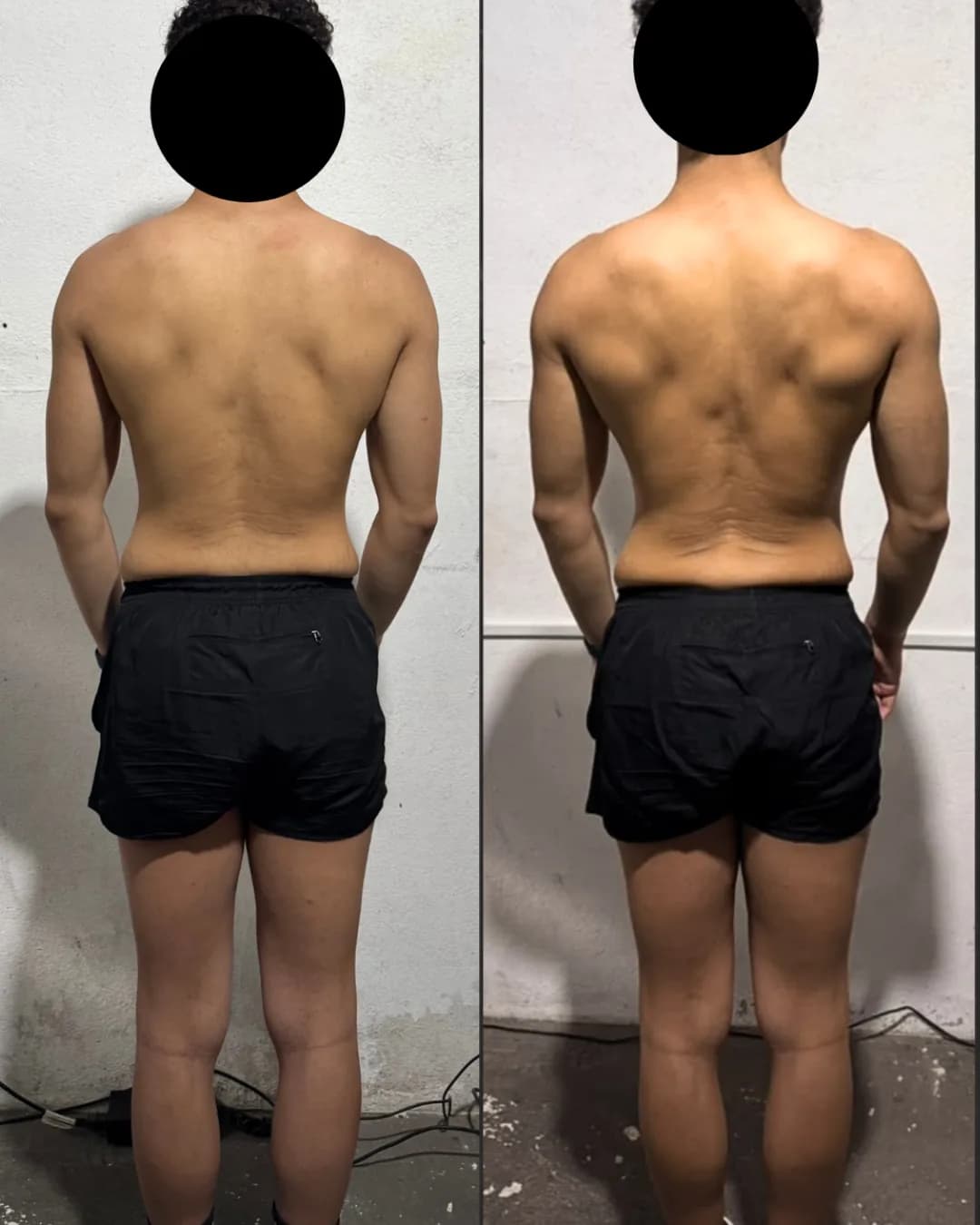 Antes e depois – resultado 12