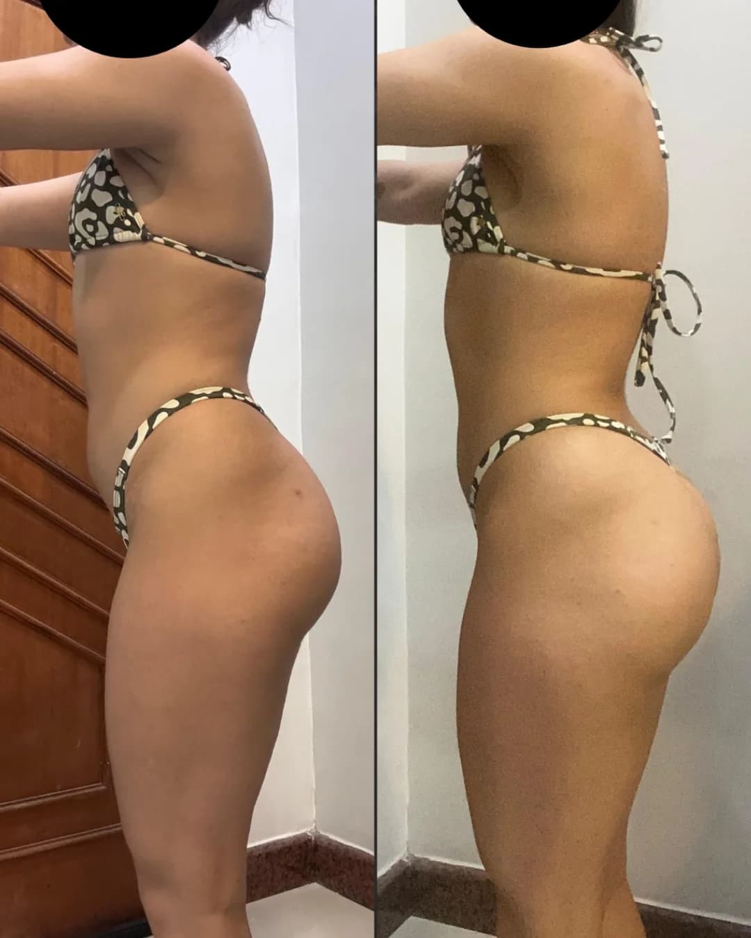 Antes e depois – resultado 2